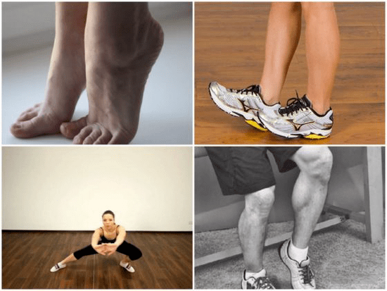 проширените вени предизвикуваат болка во нозете